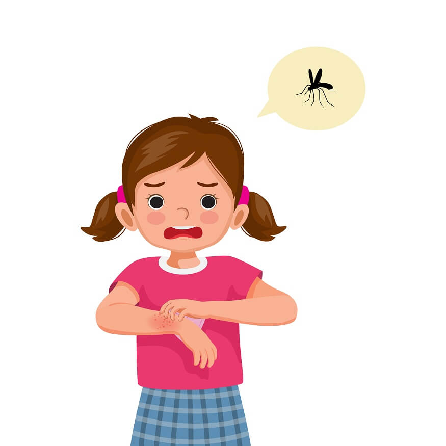 mosquito bite treatment